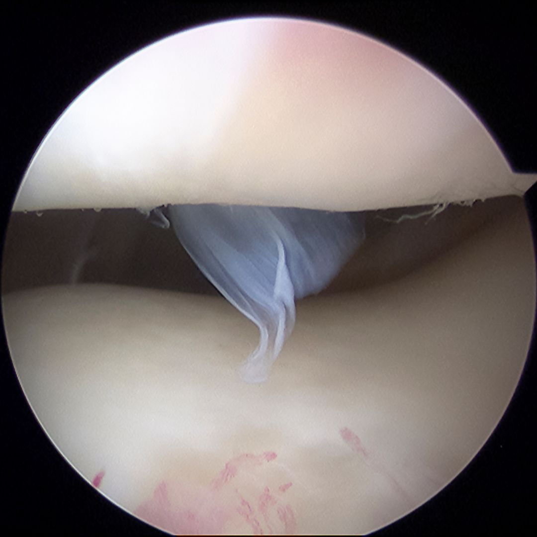 Articular Cartilage Image