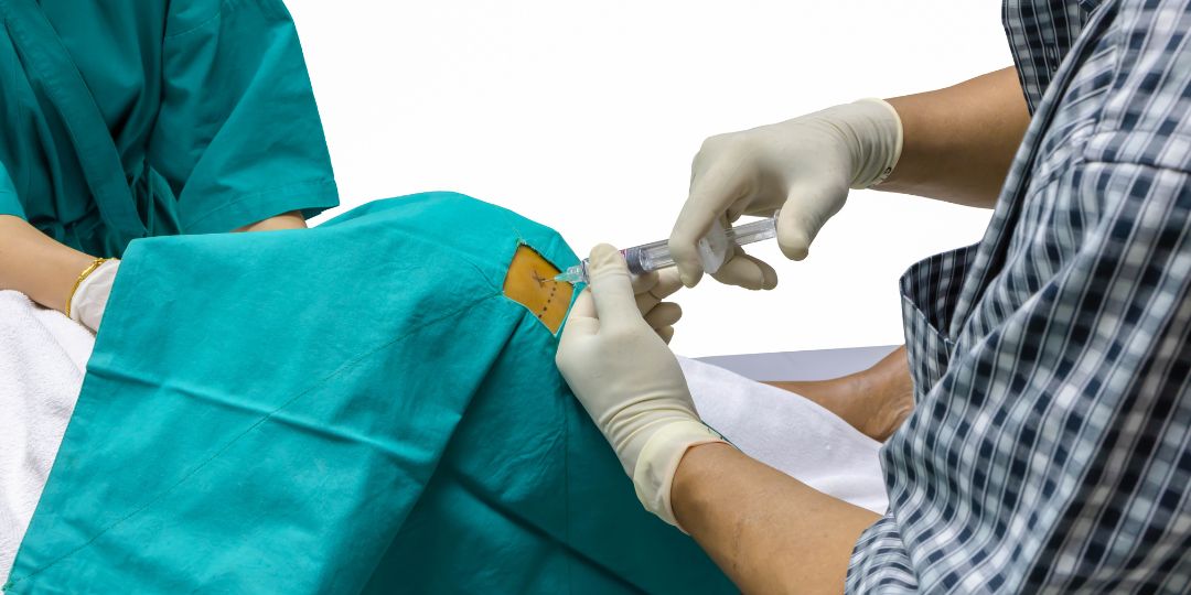 3 Powerful Truths Arthrosamid injection: Steroids, Hyaluronic Acid, Or This Hydrogel Treatment? 1 Steroid Injections Top Image